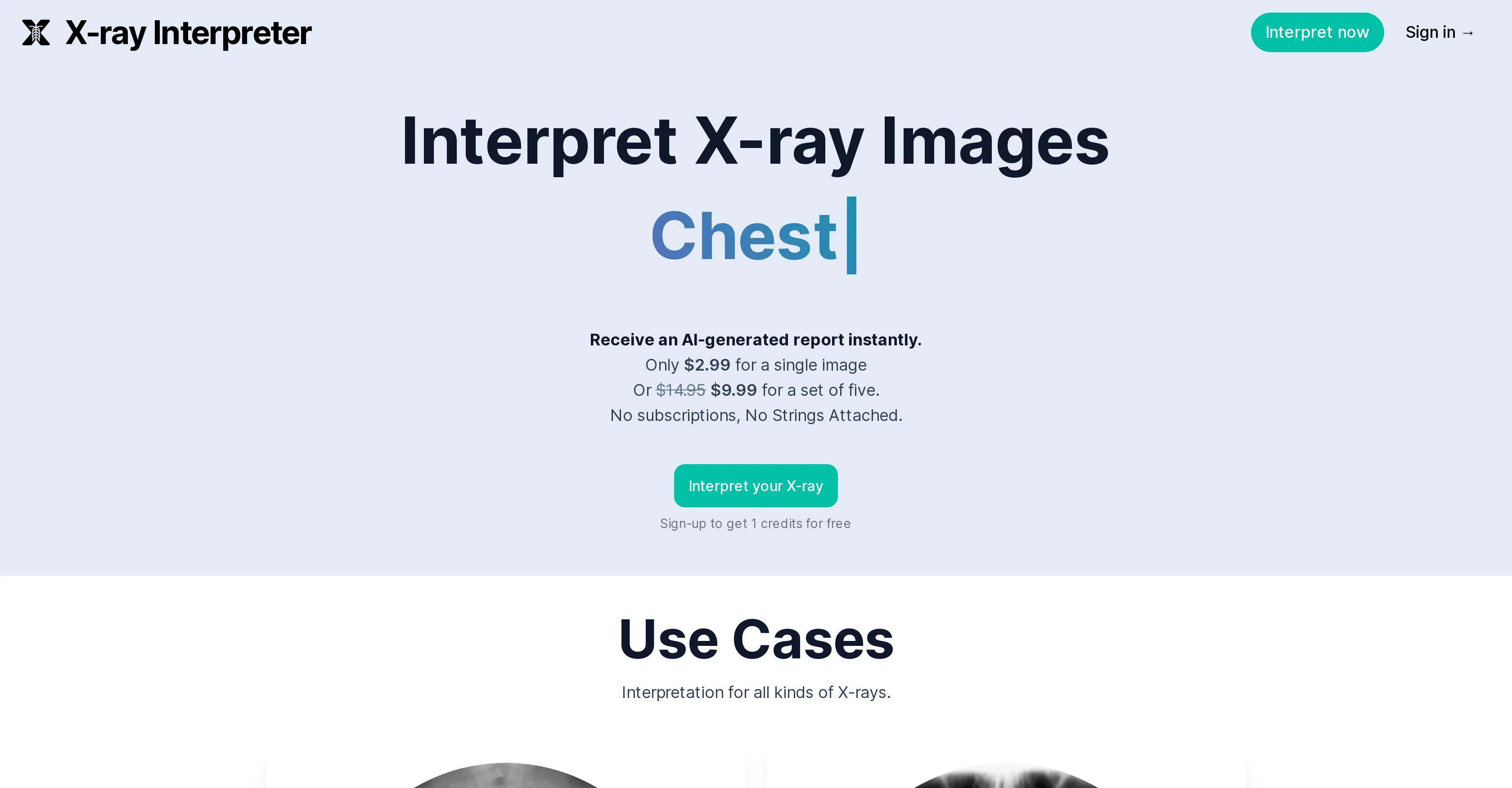 X-ray Interpreter screenshot
